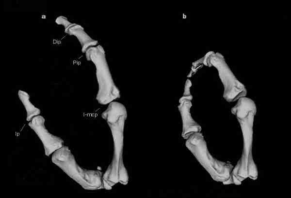 SPIRITUALITY SCIENCE - THE STATUS OF MAN IN NATURE: While the Modern Man(Homo sapiens sapiens) and Paleolithic Man( Homo sapiens neanderthalis) NEANDERTHAL have similar skeletal features that contribute to the functional ability called the 'Precision Grip', the distinction between the two can be easily made when they perform functions making use of that Grip.