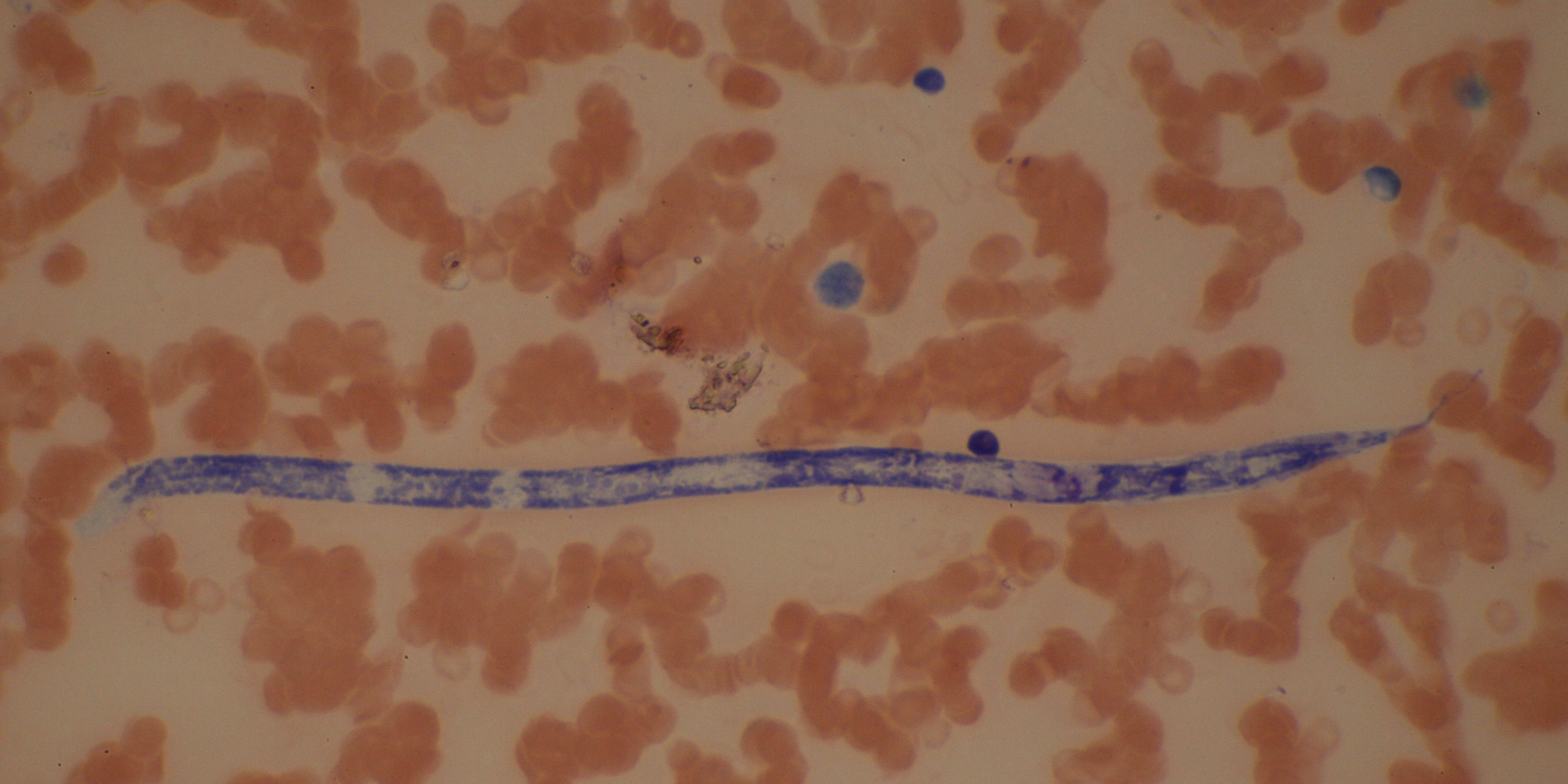 WHAT IS INTELLIGENCE? HUMAN Vs PARASITE. BRUGIA MALAYI, NEMATODE PARASITE CAUSES LYMPHATIC FILARIASIS.