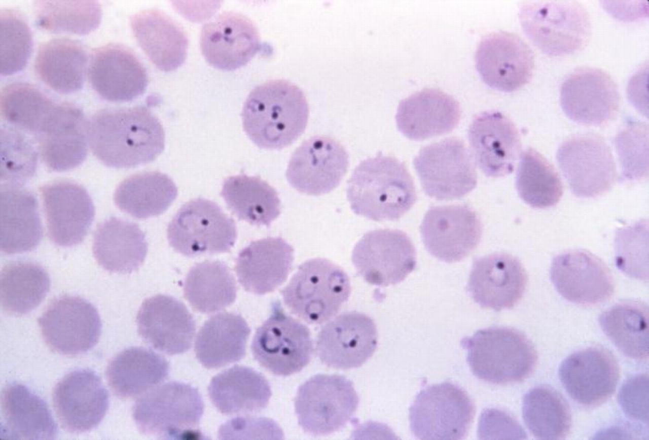 WHAT IS INTELLIGENCE? HUMAN Vs PARASITE. PLASMODIUM FALCIPARUM, PROTOZOAN PARASITE THAT CAUSES MALARIA, SEEN IN RED BLOOD CELLS OF INFECTED HOST.