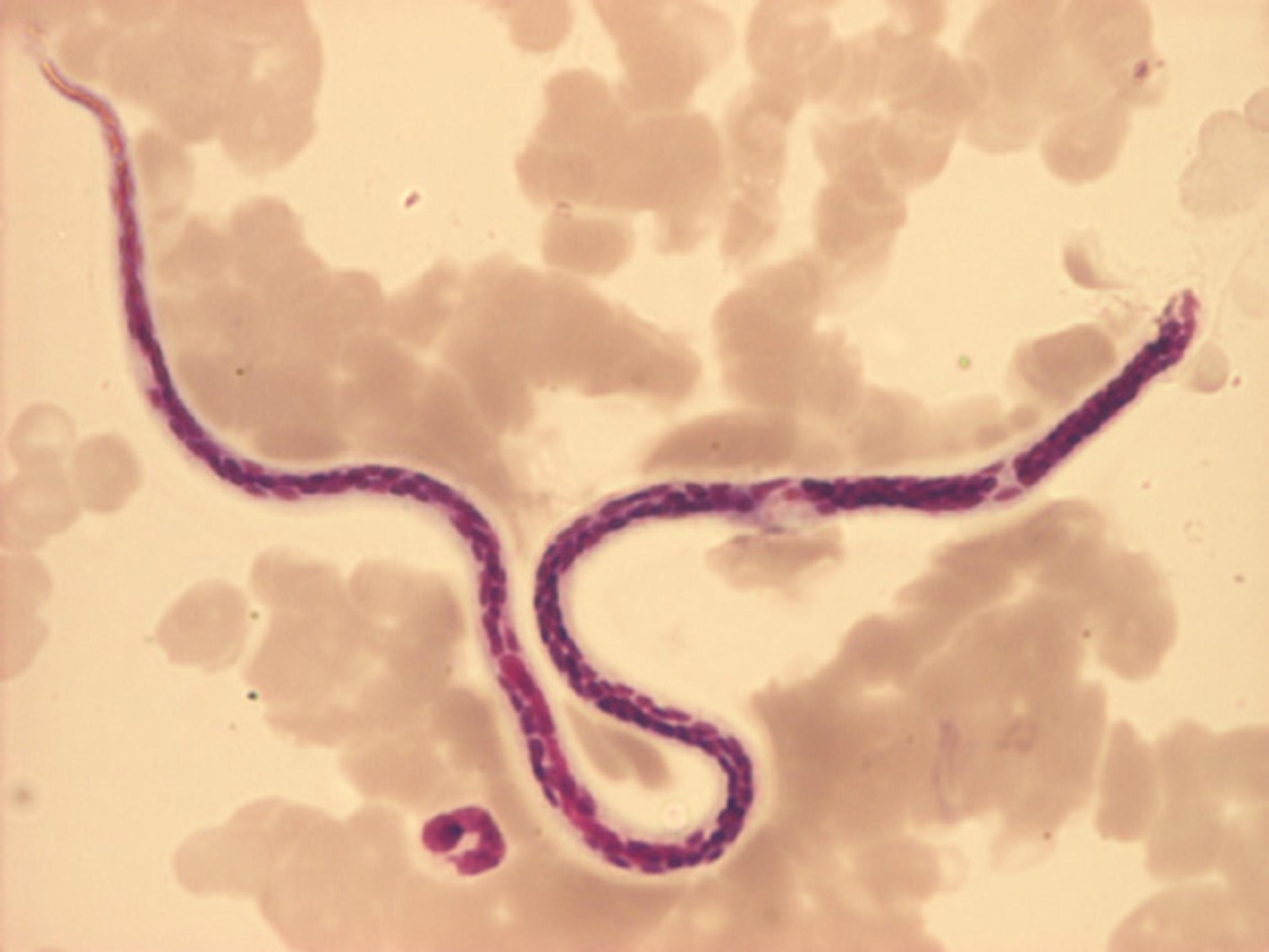 WHAT IS INTELLIGENCE? HUMAN Vs PARASITE. WUCHERERIA BANACROFTI, NEMATODE THAT CAUSES LYMPHATIC FILARIASIS.